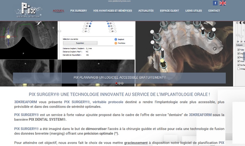 Logiciel aide implantologie dentaire